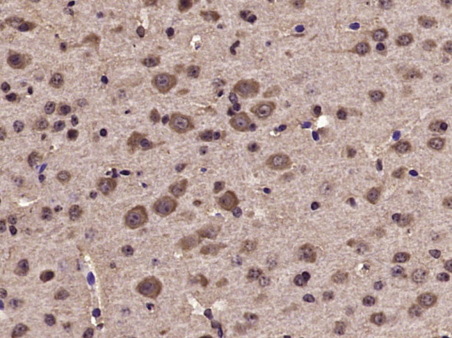 Phospho-Tyk2 (Tyr1054, Tyr1055) Antibody in Immunohistochemistry (Paraffin) (IHC (P))