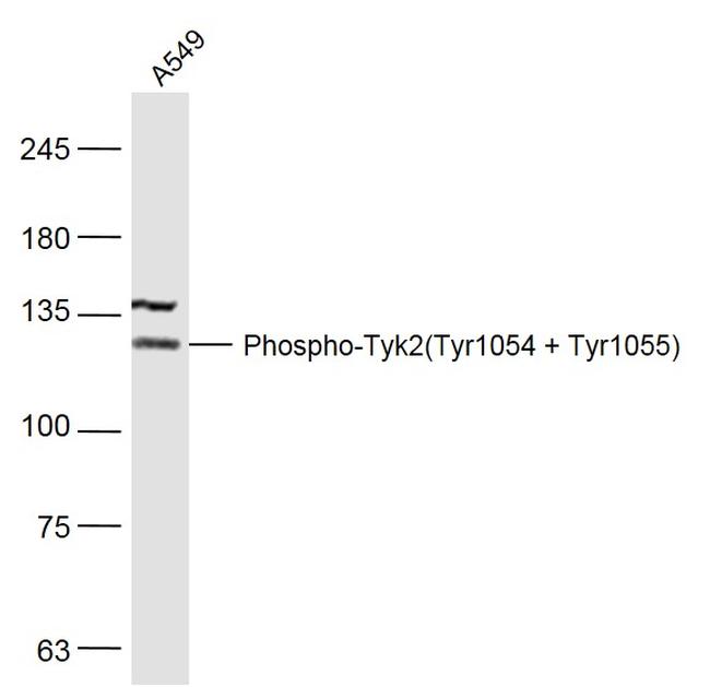 Phospho-Tyk2 (Tyr1054, Tyr1055) Antibody in Western Blot (WB)