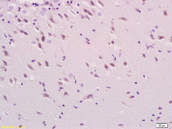 Phospho-Tau protein (Ser396) Antibody in Immunohistochemistry (Paraffin) (IHC (P))