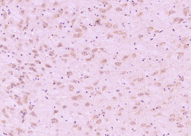 Phospho-Tau protein (Ser396) Antibody in Immunohistochemistry (Paraffin) (IHC (P))