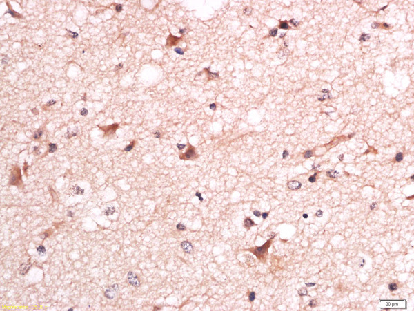 Phospho-Torc1 (Ser151) Antibody in Immunohistochemistry (Paraffin) (IHC (P))