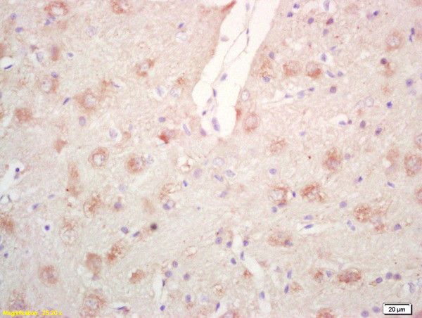 Phospho-PPIG (Ser376) Antibody in Immunohistochemistry (Paraffin) (IHC (P))