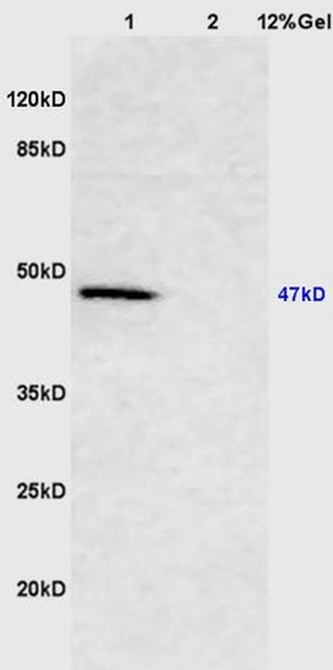 Smad2/3 Antibody in Western Blot (WB)