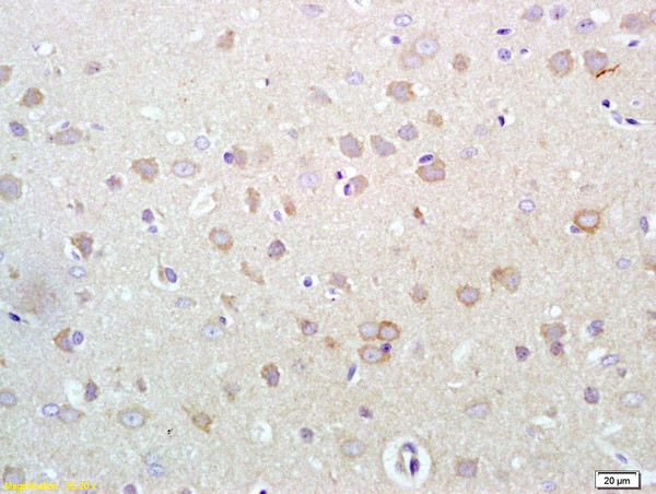 Phospho-HER3 (Tyr1289) Antibody in Immunohistochemistry (Paraffin) (IHC (P))