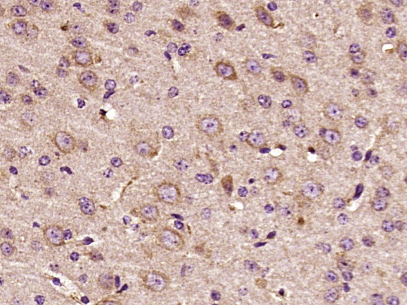 Phospho-HER3 (Tyr1289) Antibody in Immunohistochemistry (Paraffin) (IHC (P))