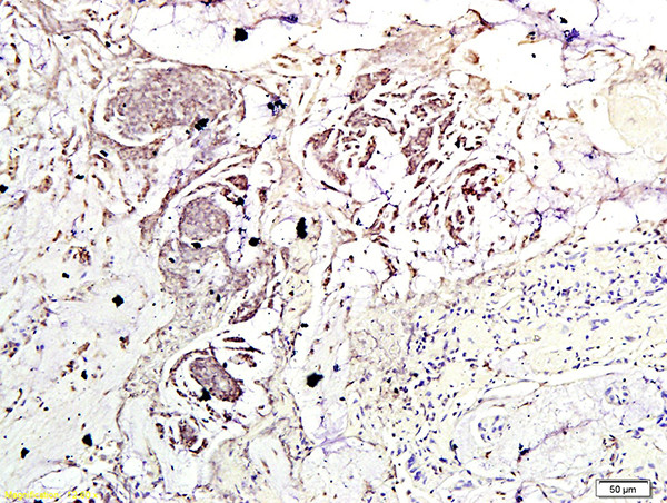 Phospho-mTOR (Ser2448) Antibody in Immunohistochemistry (Paraffin) (IHC (P))