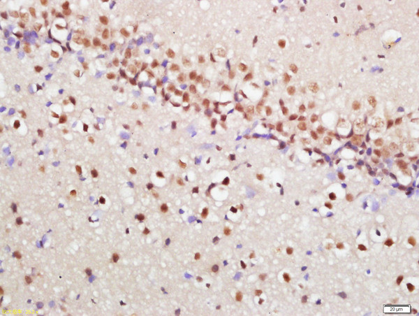 Phospho-mTOR (Ser2448) Antibody in Immunohistochemistry (Paraffin) (IHC (P))