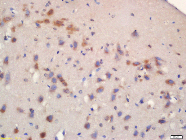 Phospho-mTOR (Ser2481) Antibody in Immunohistochemistry (Paraffin) (IHC (P))