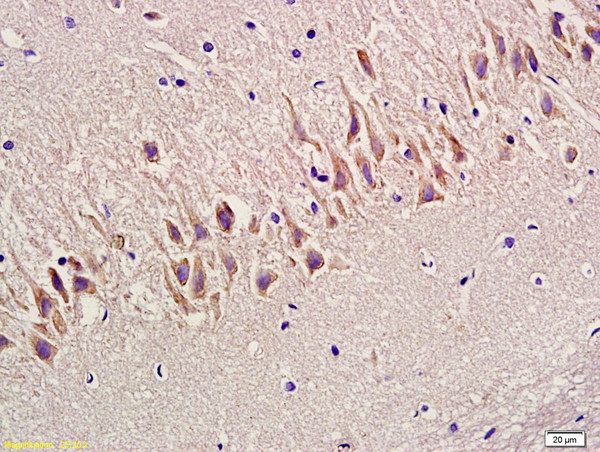 Synapsin 1 Antibody in Immunohistochemistry (Paraffin) (IHC (P))