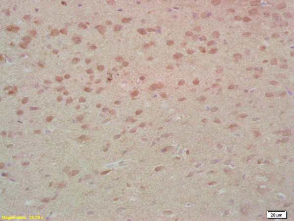 MST1 Antibody in Immunohistochemistry (Paraffin) (IHC (P))