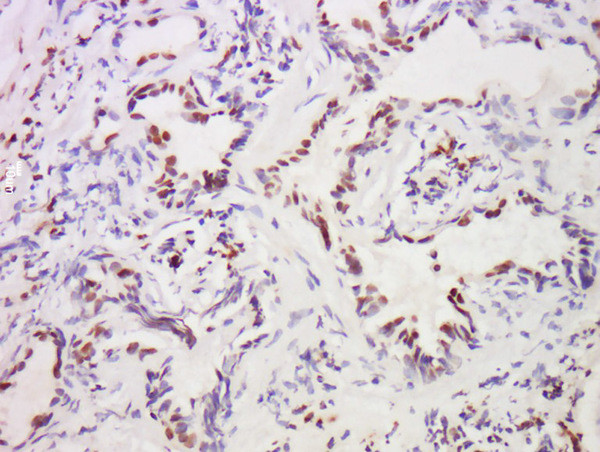 MST1 Antibody in Immunohistochemistry (Paraffin) (IHC (P))