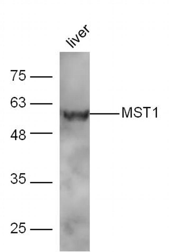 MST1 Antibody in Western Blot (WB)