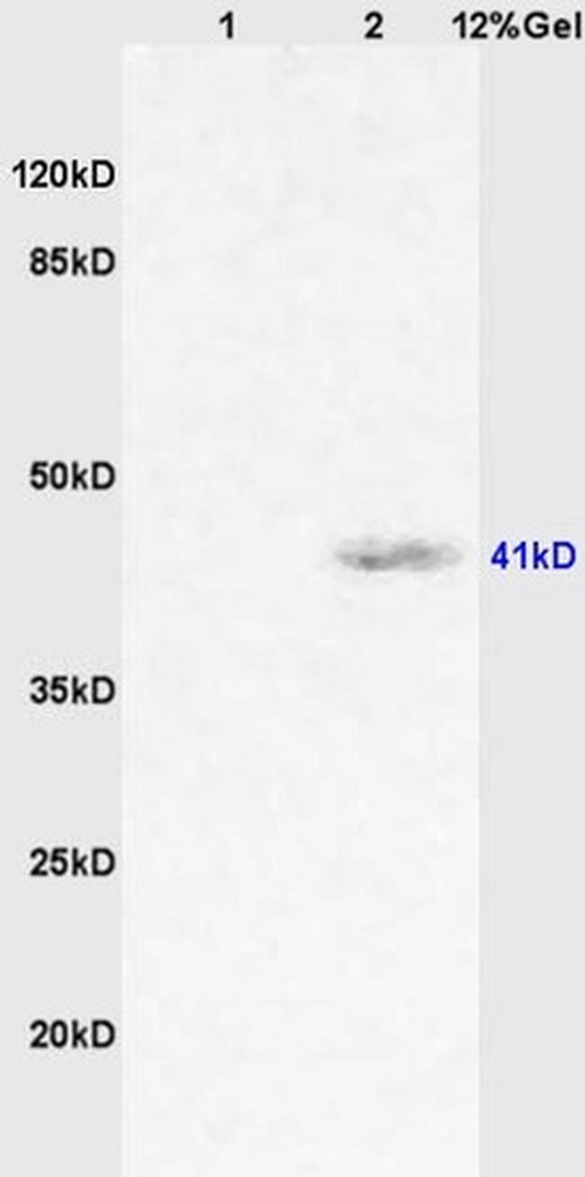 CD64/IGFR1 Antibody in Western Blot (WB)