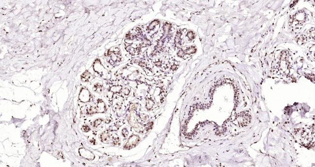 NuMA Antibody in Immunohistochemistry (Paraffin) (IHC (P))