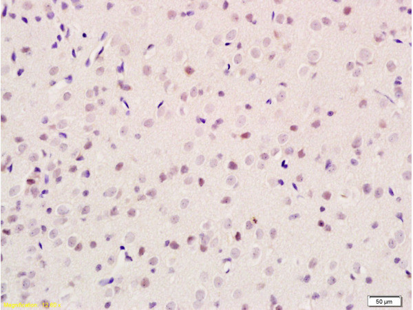 ID2 Antibody in Immunohistochemistry (Paraffin) (IHC (P))