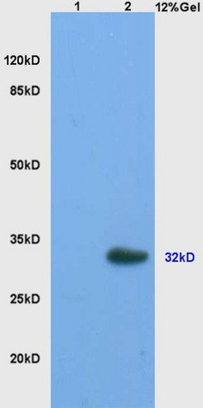 StAR Antibody in Immunohistochemistry (Paraffin) (IHC (P))