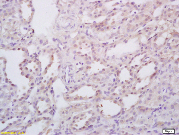 StAR Antibody in Immunohistochemistry (Paraffin) (IHC (P))