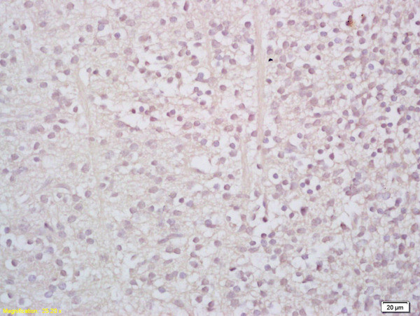 StAR Antibody in Immunohistochemistry (Paraffin) (IHC (P))