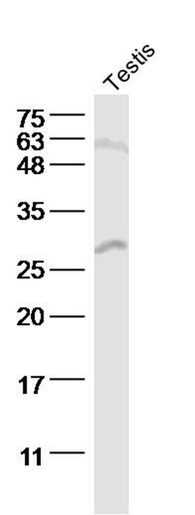 StAR Antibody in Western Blot (WB)