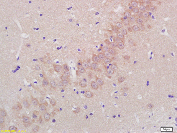 ADAMTS5 Antibody in Immunohistochemistry (Paraffin) (IHC (P))