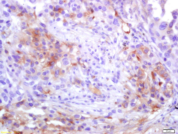 ADAM10 Antibody in Immunohistochemistry (Paraffin) (IHC (P))