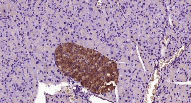 TCTP Antibody in Immunohistochemistry (Paraffin) (IHC (P))