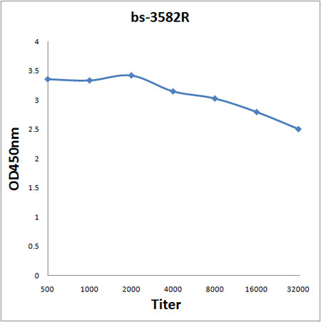 TIF1 gamma Antibody in ELISA (ELISA)