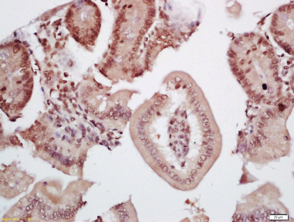 TIF1 gamma Antibody in Immunohistochemistry (Paraffin) (IHC (P))