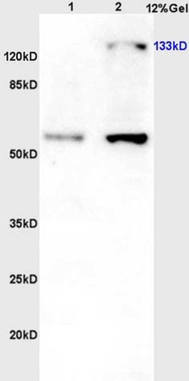 Phospho-eNOS (Thr113) Antibody in Western Blot (WB)