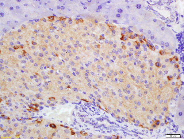 ATG1/ULK1 Antibody in Immunohistochemistry (Paraffin) (IHC (P))