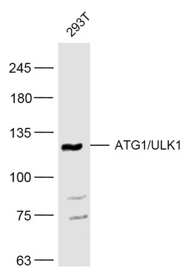 ATG1/ULK1 Antibody in Western Blot (WB)