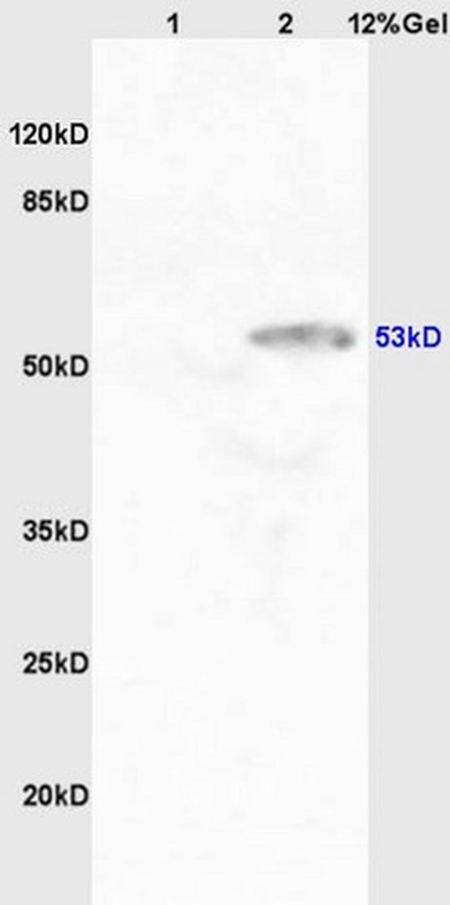 CYP11A1 Antibody in Western Blot (WB)