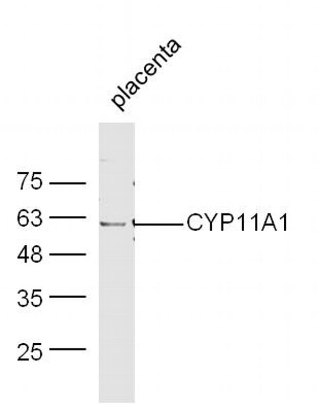 CYP11A1 Antibody in Western Blot (WB)