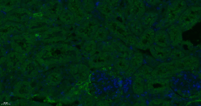 ESM1 Antibody in Immunohistochemistry (Paraffin) (IHC (P))