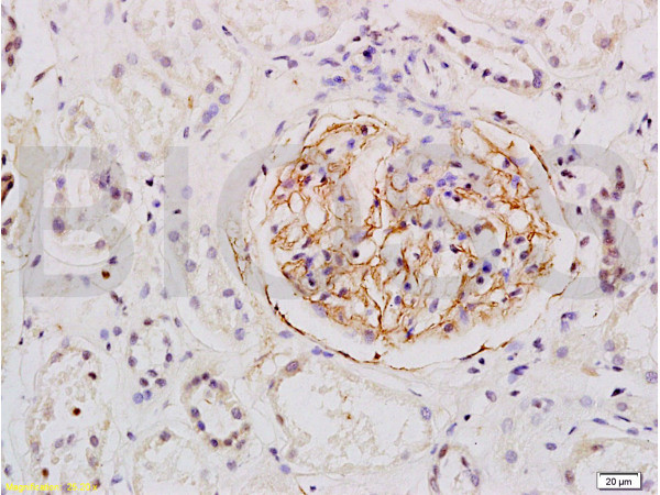 ESM1 Antibody in Immunohistochemistry (Paraffin) (IHC (P))