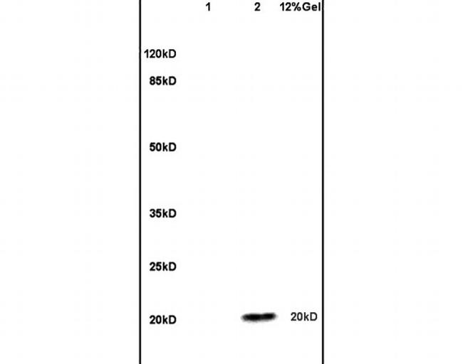 ESM1 Antibody in Western Blot (WB)