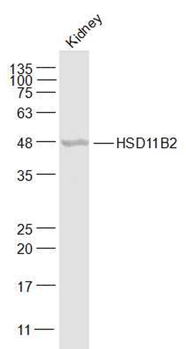 HSD11B2 Antibody in Western Blot (WB)