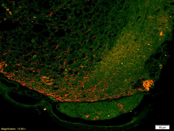 FPRL1/Lipoxin A4 receptor Antibody in Immunohistochemistry (Paraffin) (IHC (P))