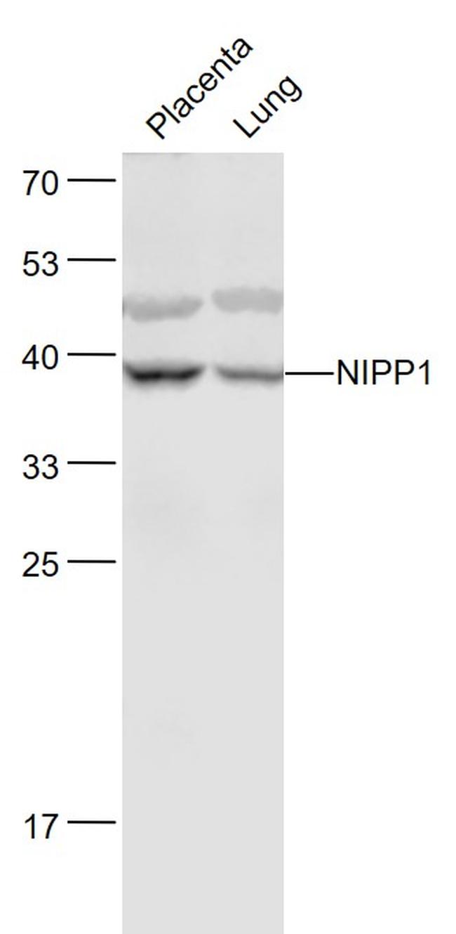 NIPP1/ARD1 Antibody in Western Blot (WB)