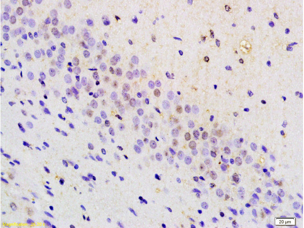 BRN3A Antibody in Immunohistochemistry (Paraffin) (IHC (P))