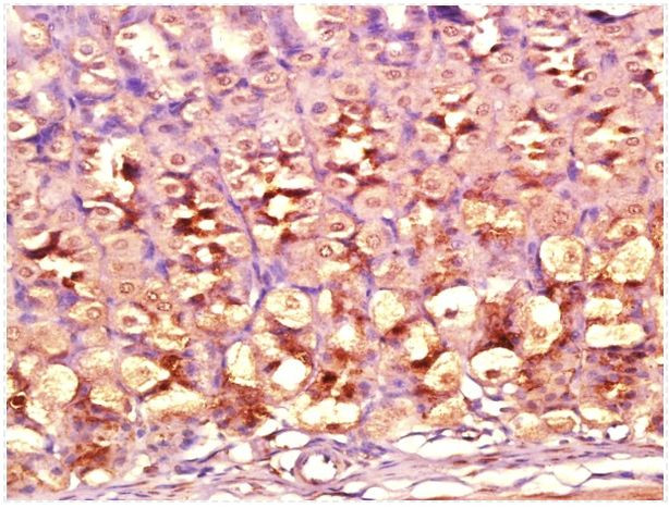 DIO2 Antibody in Immunohistochemistry (Paraffin) (IHC (P))