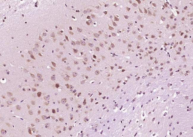 DIO2 Antibody in Immunohistochemistry (Paraffin) (IHC (P))