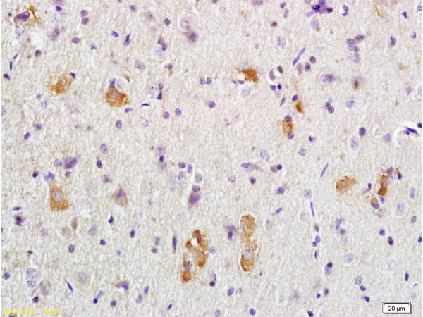 Adenomatous Polyposis Coli Antibody in Immunohistochemistry (Paraffin) (IHC (P))