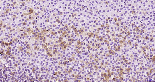 ADCY1 Antibody in Immunohistochemistry (Paraffin) (IHC (P))