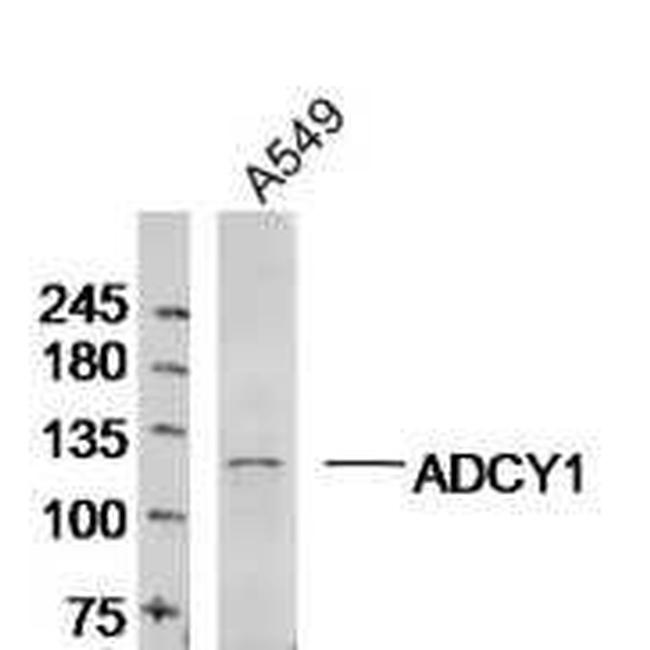 ADCY1 Antibody in Western Blot (WB)