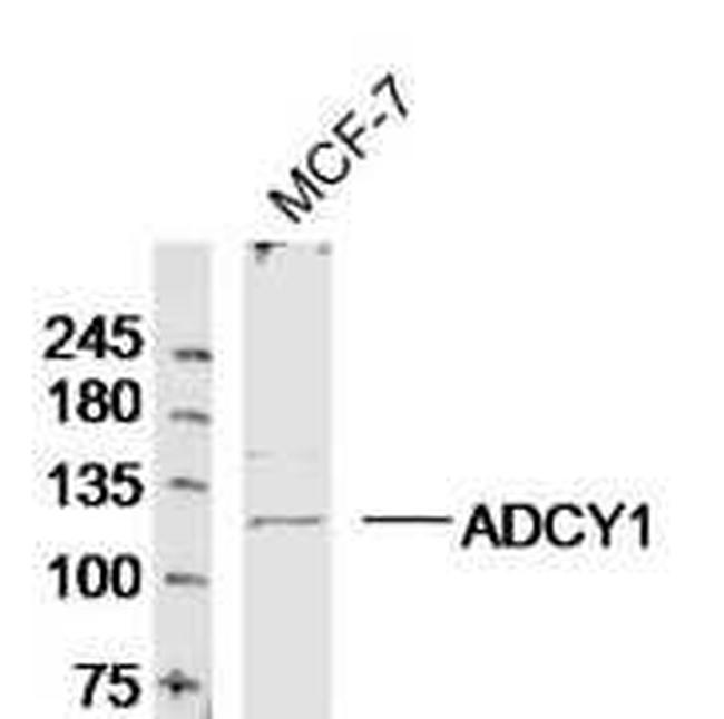 ADCY1 Antibody in Western Blot (WB)