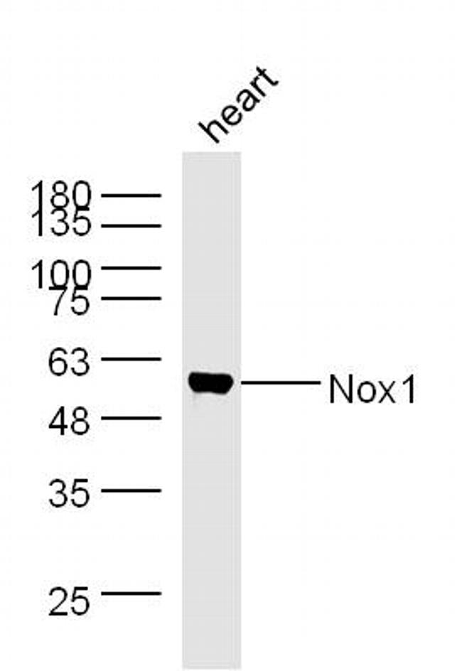 Nox1/NADPH oxidase 1 Antibody in Western Blot (WB)