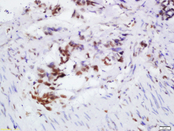 OGG1 Antibody in Immunohistochemistry (Paraffin) (IHC (P))