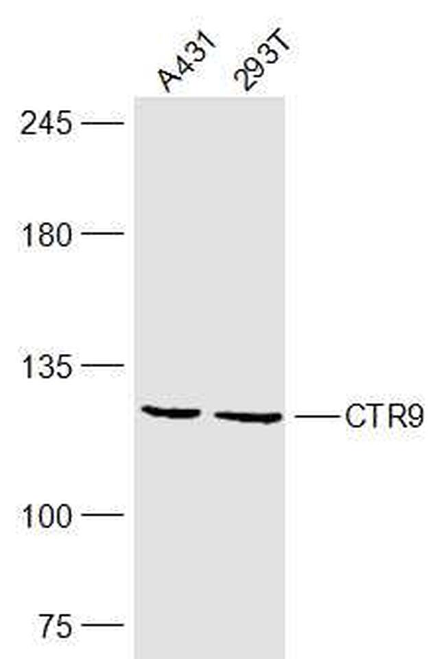 CTR9 Antibody in Western Blot (WB)