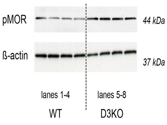 Phospho-mu Opioid Receptor (Ser375) Antibody in Western Blot (WB)